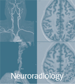 Neuroradiology Brochure