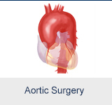 Aortic Aneurysm Surgery