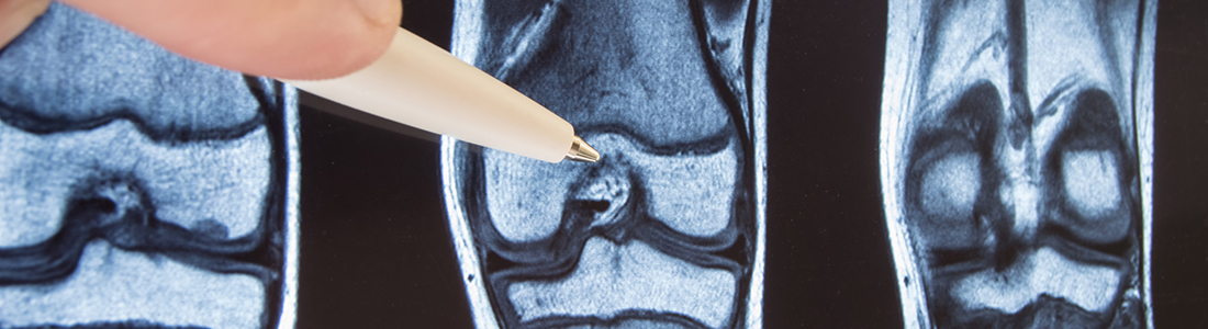 Rheumatology