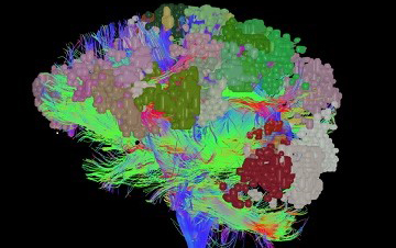 Westchester Medical Center Charts Course for Successful Neurosurgery Outcomes with New “Brain Mapping” Technology